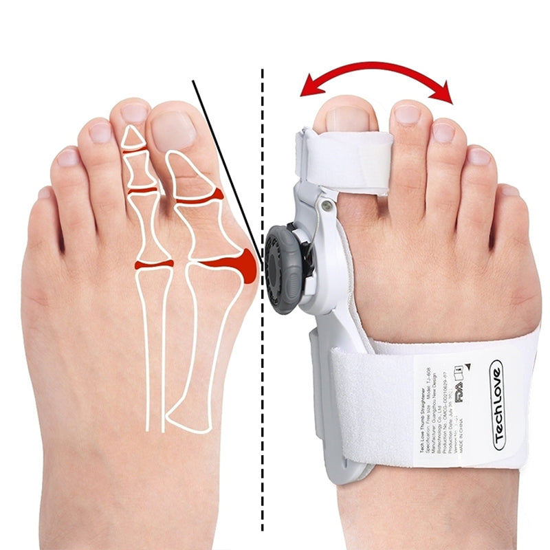 Premium 3D Knob Bunion Corrector for Pain Relief and Toe Alignment