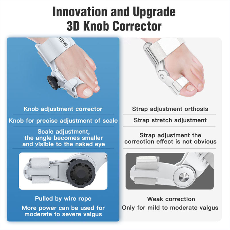 Premium 3D Knob Bunion Corrector for Pain Relief and Toe Alignment