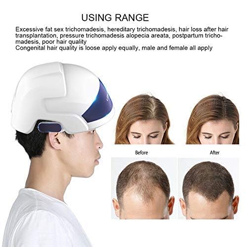 Laser Hair Growth Helmet Hair Loss Therapy