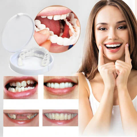 Instant Smile Comfort Upper & Lower Veneer Set