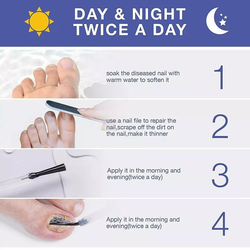 Fingernail Fungus Treatment