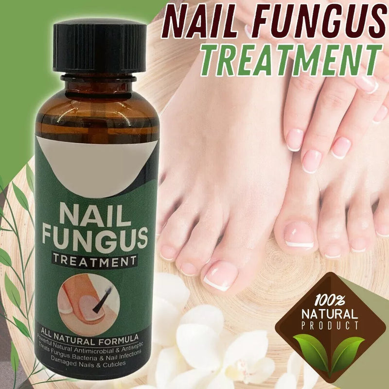 Fingernail Fungus Treatment