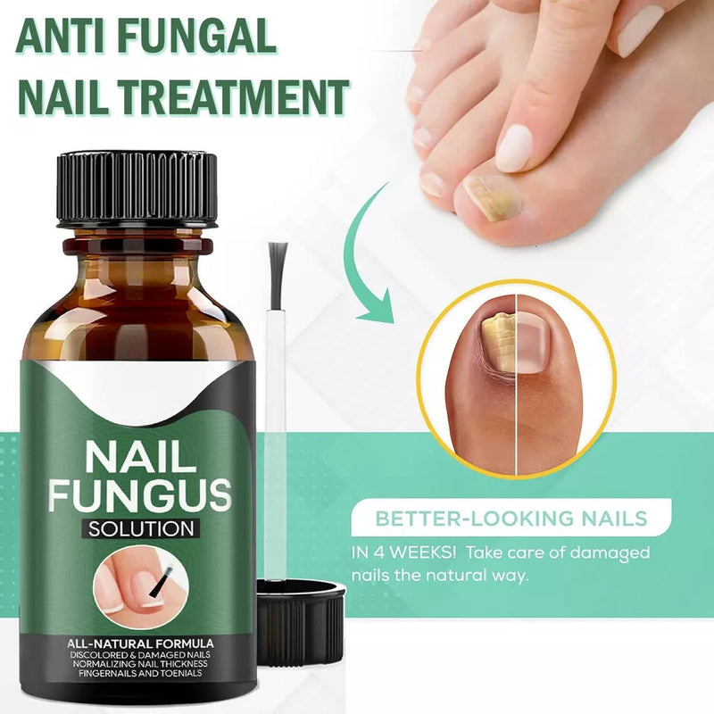 Fingernail Fungus Treatment