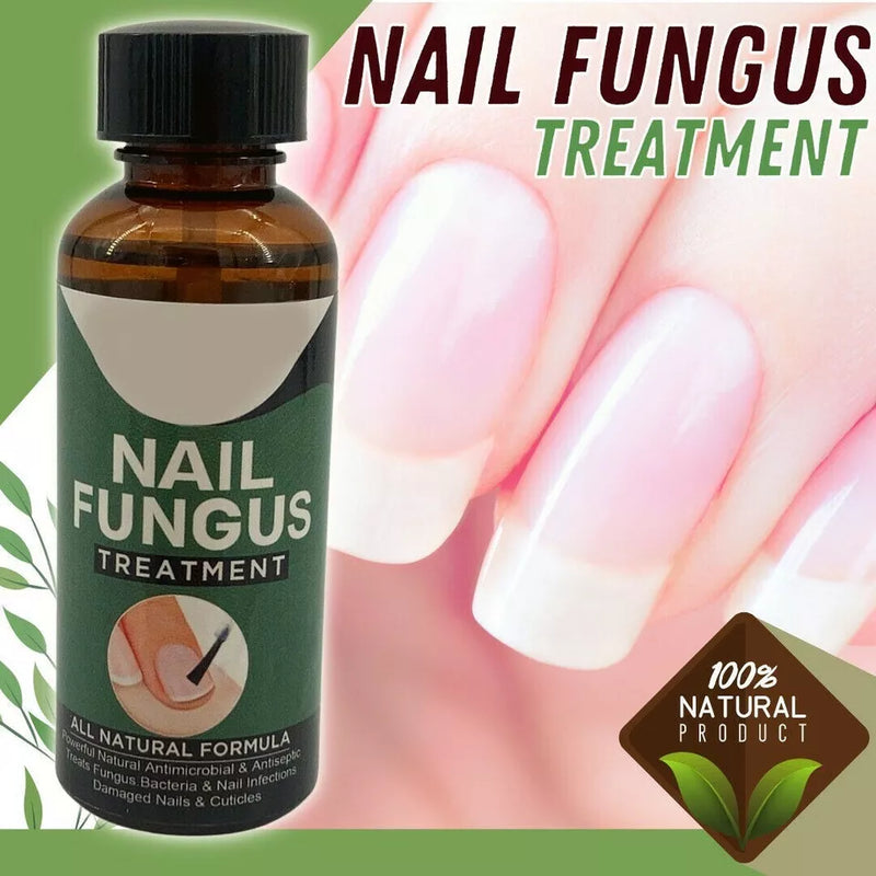 Fingernail Fungus Treatment