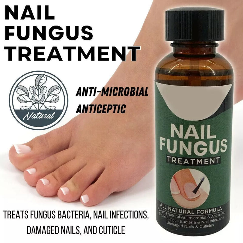 Fingernail Fungus Treatment