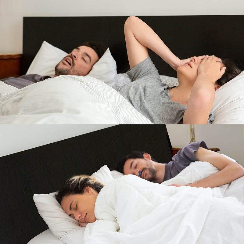Airing - Anti Snoring Device | Hoseless, Maskless Micro CPAP